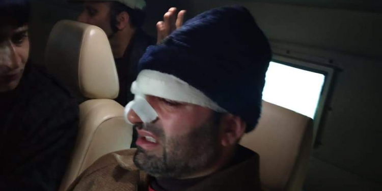 Dy Mayor injured in assault during councilor session, hospitalized