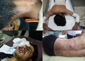 Pakistan strongly condemns firing of pellets and tear gas shells on Muharram procession in Kashmir