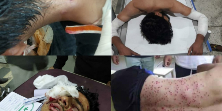 Pakistan strongly condemns firing of pellets and tear gas shells on Muharram procession in Kashmir