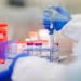Omicron: DAK reiterates demand to set up genetic testing lab in Kashmir