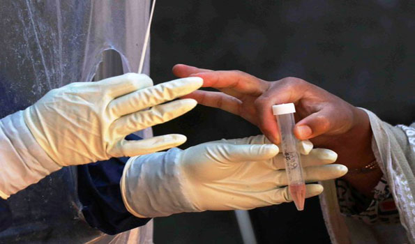 India records 2,593 new Covid -19 cases
