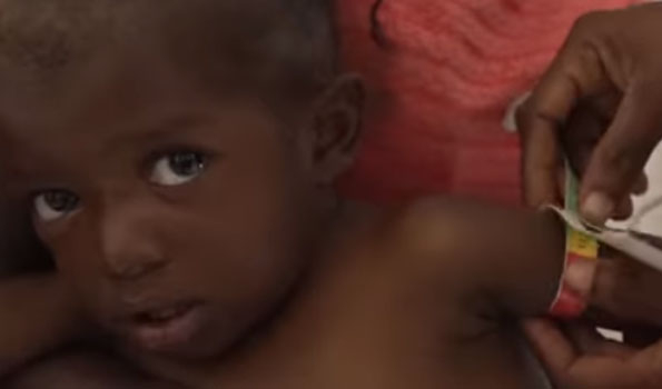 UNICEF reports over 7 mln malnourished children fewer than 5 in Horn of Africa