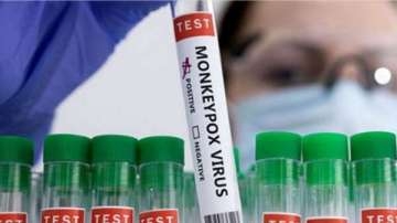 Director SKIMS Reviews measures on M-pox